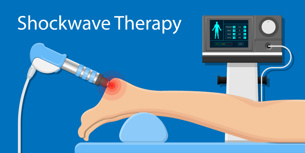 Shockwave Therapy