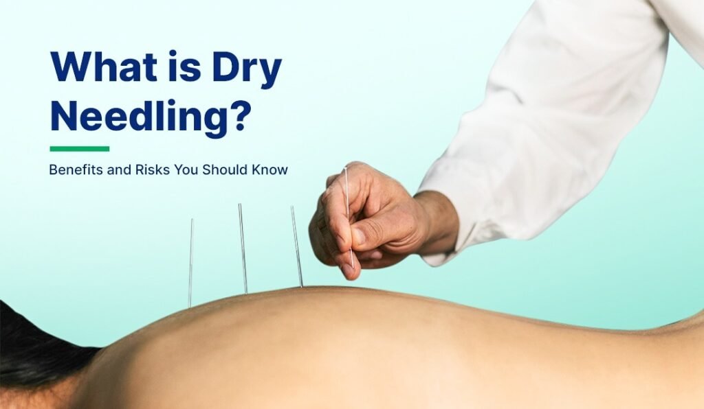 Dry Needling