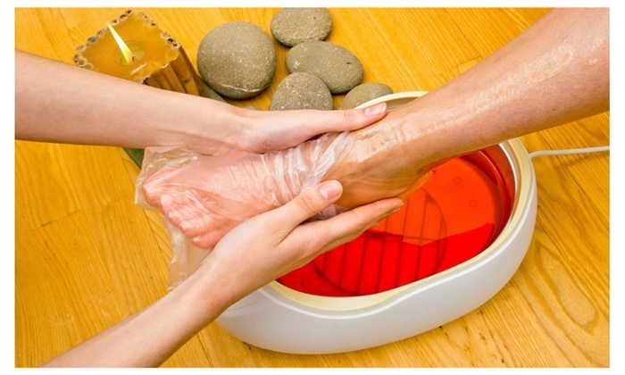 Wax Bath Therapy at Neuro Robotic Physiotherapy Ranchi